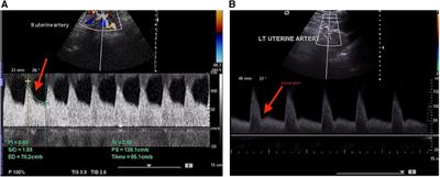 Color Doppler ultrasound in high-low risk pregnancies and its relationship to fetal outcomes: a cross-sectional study